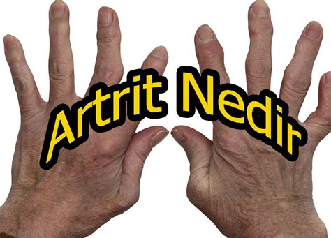artrit hastalığı ne demek